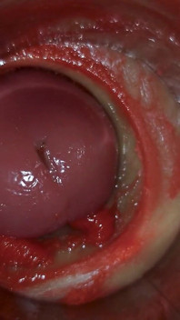 Camera dentro la figa profonda cattura un enorme eiaculazione di sperma ASMR