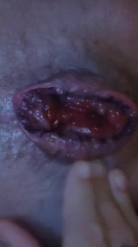 My Hole