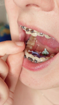 Giantess Devour Fetish in Braces