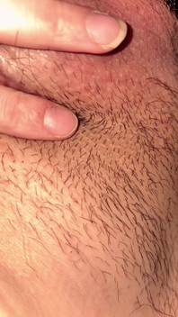 Help I Can’t Cum