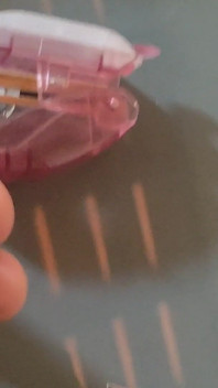 Intense Pleasure Stapling Phimosis.