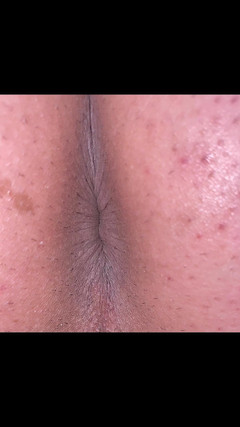 Kyotosigakk: Một người đàn ông để lộ lỗ đít của mình Chụp ảnh để nếp nhăn có...