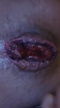 My Hole