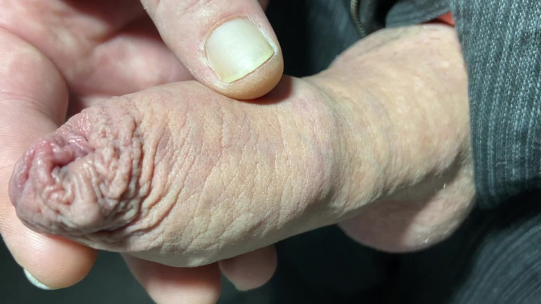 Foreskinguy: 与大鸡巴头缓慢包皮撸管