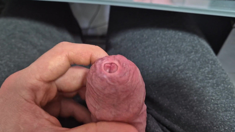 GloomyChase977: Těsná předkožka se protahuje s výstřikem!