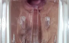 窥镜子宫颈高潮射精