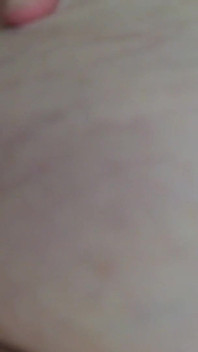 SSBBW up Close Body Exploration Stretch Marks