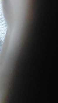 Bulge Xl