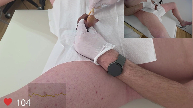 Clinical Climax: 16 Franse Foley Invoeging