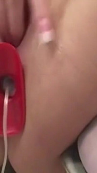Rosebud Prolapse Popping efter anal leksakssträckning