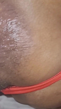 Trying to Get the Sperm Out, It Was so Deep That It Didn't Come Out