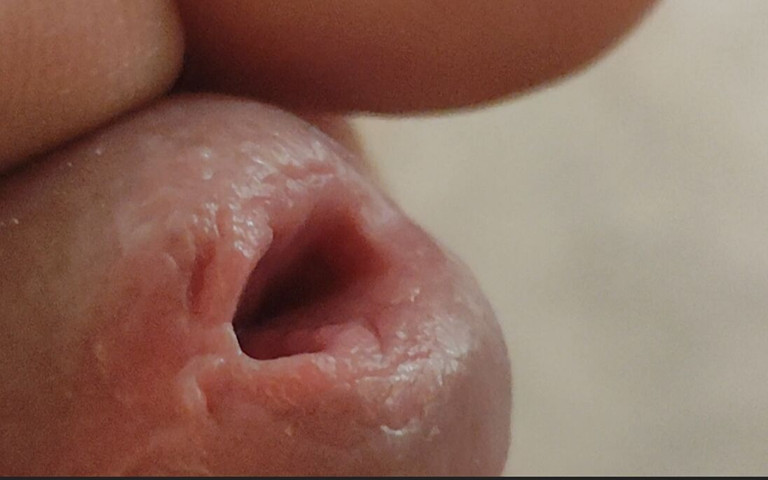 Entering the Glans of Pleasure! (Straight Daddy Club) Entering the Glans of Pleasure! (Straight Daddy Club)