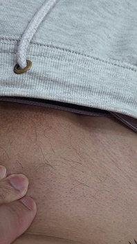 The Hair on My Penis - Led Hair Removal