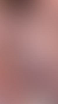 Pierced Chubby Guy Sounding with 3mm - 4mm and 5mm - 6mm Hegar