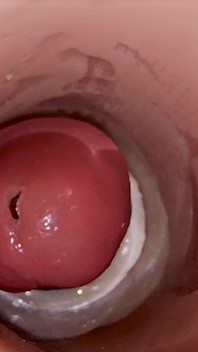 Camera Inside Deep Pussy Captures Huge Ejaculation of Sperm
