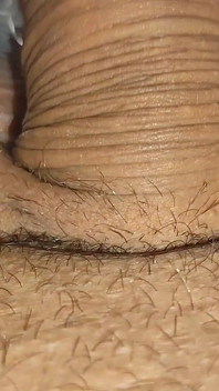 Gizemli Çözelti Buruşuk Penise Yerleştirildi.
