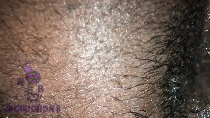 NB Topper: Siyah Yetiştiriciler 31