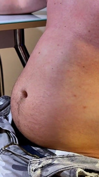 Geschwollene Perfektion - Privater Check-up