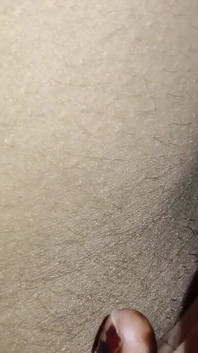 Chị kế móc cua
