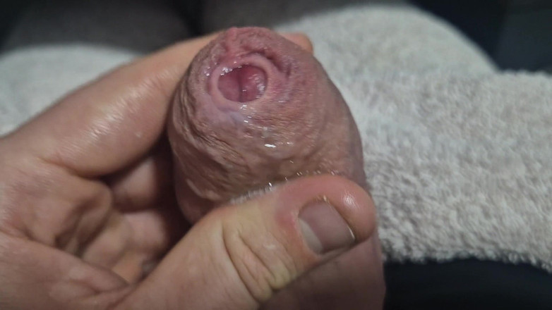 GloomyChase977: Uncut Tight Phimosis Cock Foreskin Stretched Close up