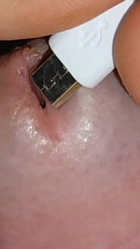 电介绍进入开放。