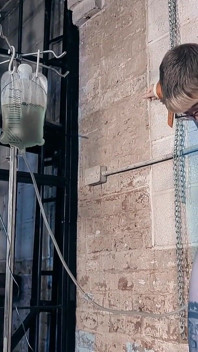Připoutaná ke zdi pro klystýr a elektriku
