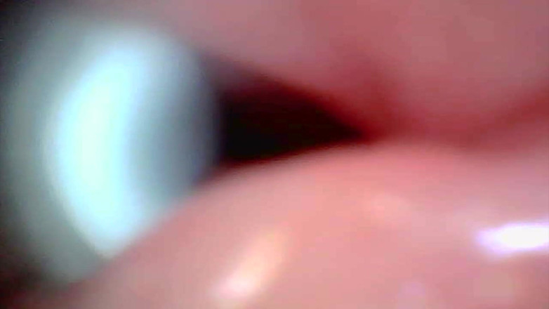 Ladybottox: Endoskopische Kamera Nimmt Moment Der Männlichen Ejakulation Ein 4K