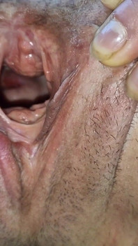 Sehen Sie in meiner vagina mit Gebärmutterhals zeigen im freien und pissen