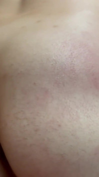 Henüz blistered veya bruised değil