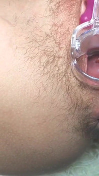 Una figa aperta usando un speculum_orgasm in primo piano durante