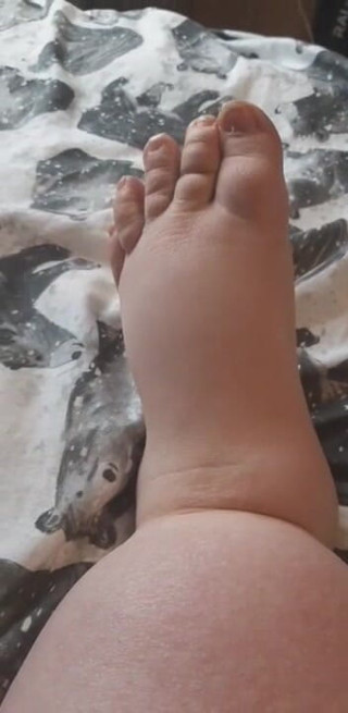 SSBBWLadyBrads: Fat chubby feet