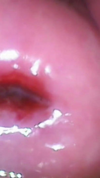 Extremo close-up na buceta