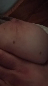 Brustmassage intensivo