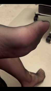 Nylon Feet