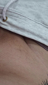 The Hair on My Penis - Led Hair Removal