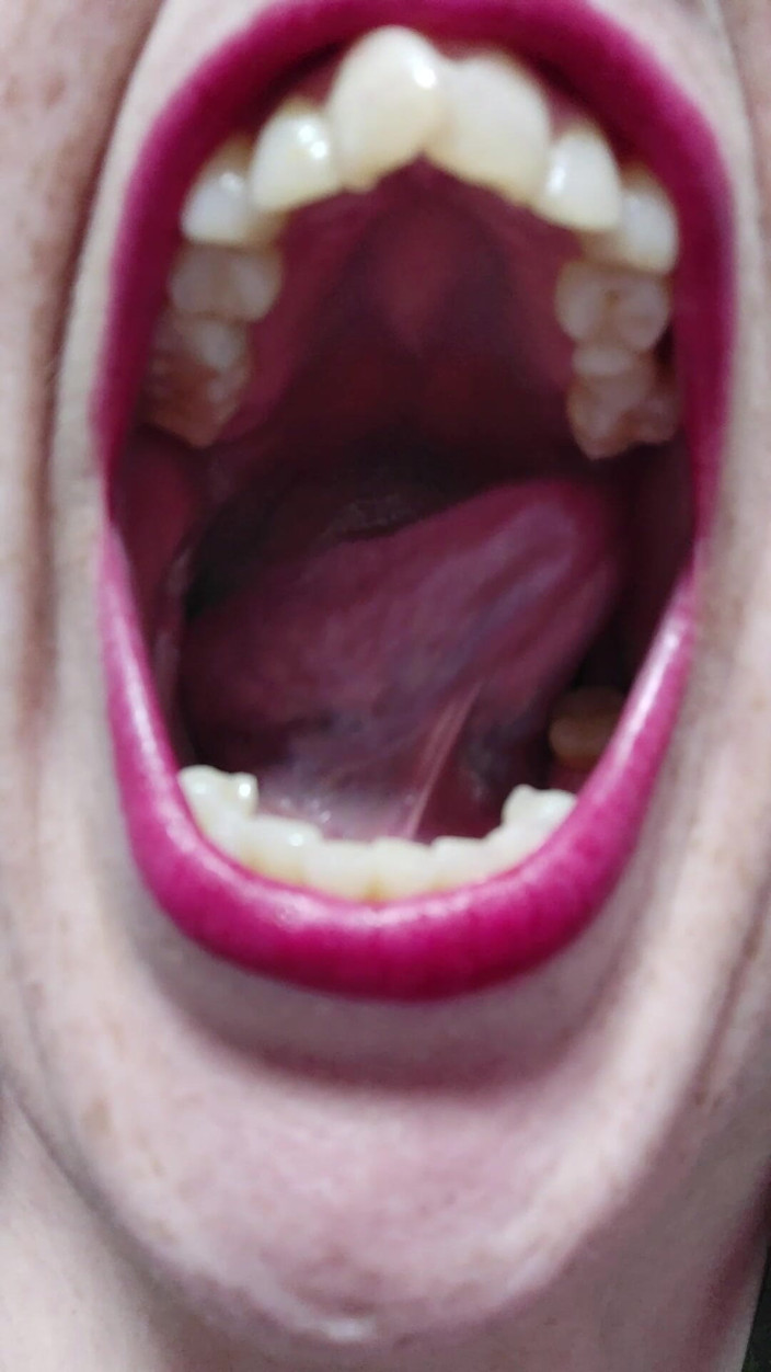 AngYourDirtyCanadian: Some Mouth Togue and Teeth