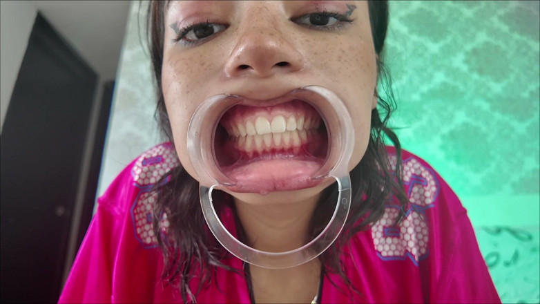 KiyuSweetCrazy: Cheeks Pulled Apart Teeth Exposed
