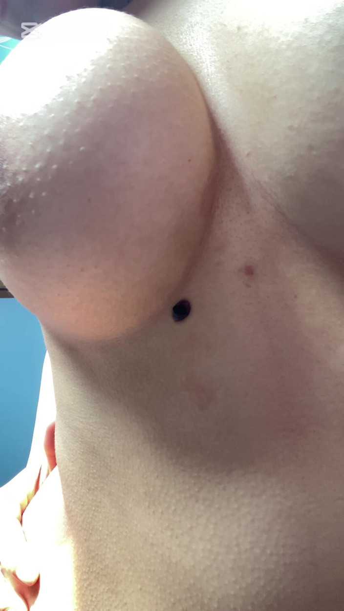 Nepalii: Chcesz się przytulić?