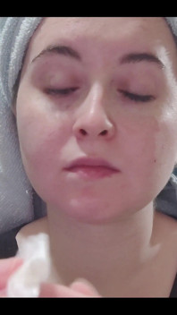 My ear cleaning routine starts with cotton swabs and then gauze.