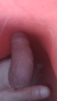 My Dick