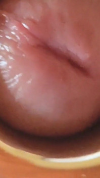 Boy Close up Tight Uncircumcised Glans Excited