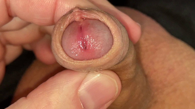 Wichskumpel: Sünneti küçük sulu yarakla oynuyor