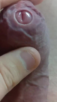 Big Uncut Tight Forskin Cock - Phimosis, Short Cock Play