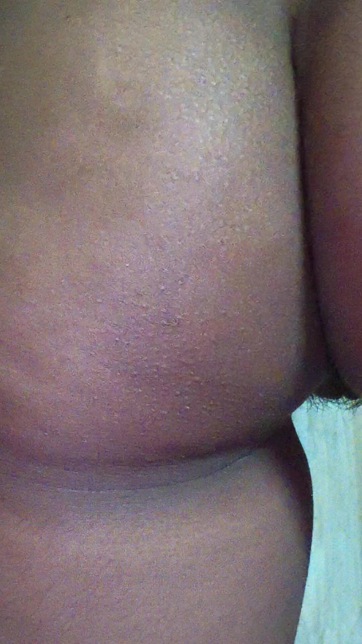 Moma: Untuk Audiens India