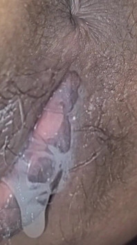Pârțuri vaginale
