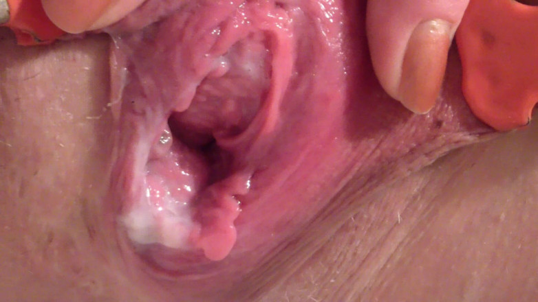 deep keely: Tutup Kompilasi Pis 7