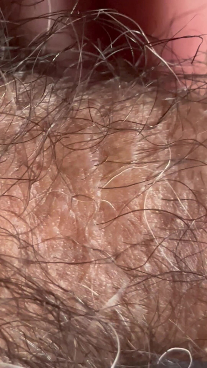 ragil01: Closeup of Penis with One Vein
