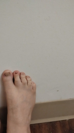 JG Risk: 2025-11-26 可爱的小脚趾