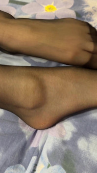 Seorang siswa dengan rok pendek dan stoking hitam membuat celana dalamnya