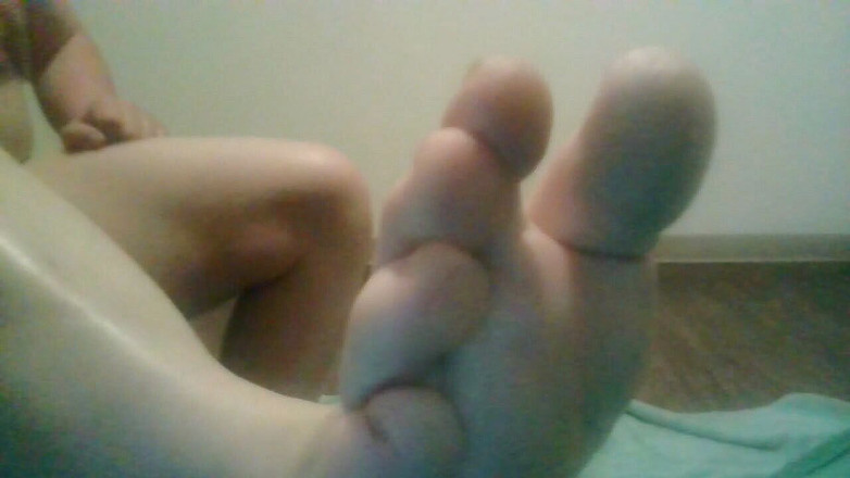 JG Risk: Pravá noha